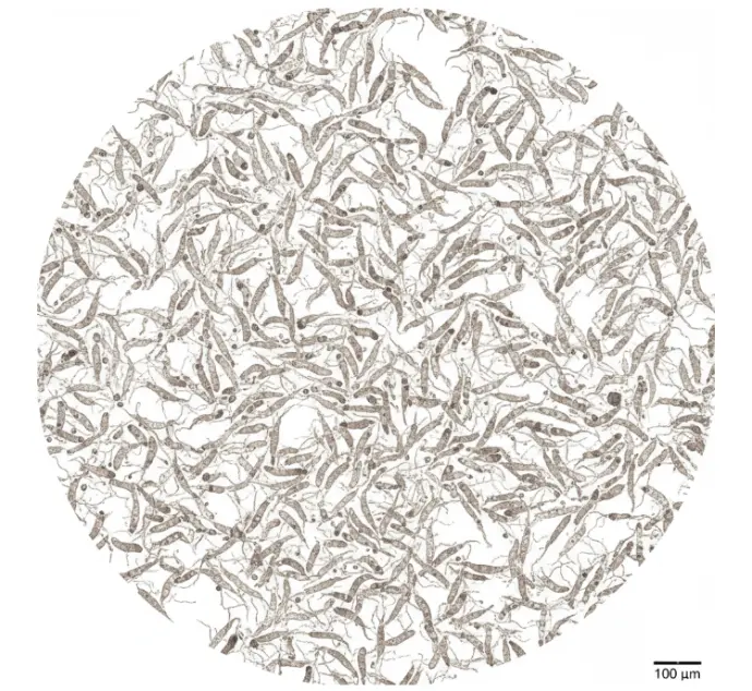 Human Lung Squamous Cell Carcinoma CAFs